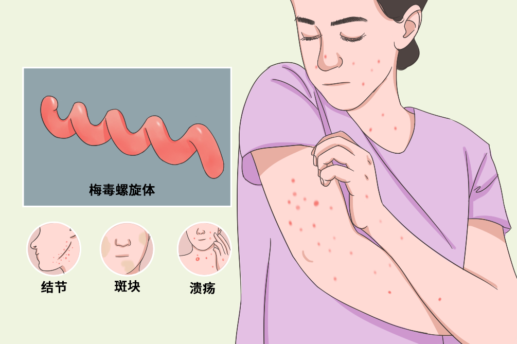 关注性病防治拥抱健康生活